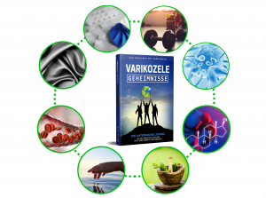 Varicocele-Geheimnisse-Infografik